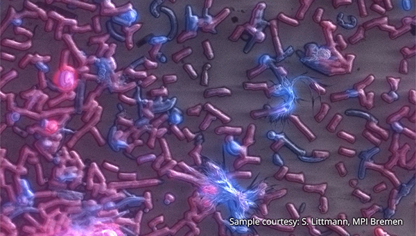 Webinar on Correlative Light and Electron Microscopy